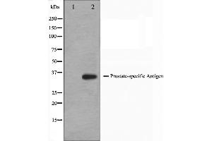 Western blot analysis on mouse heart cell lysate using KLK3 Antibody,The lane on the left is treated with the antigen-specific peptide. (Prostate Specific Antigen antibody  (Internal Region))