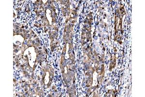 IHC analysis of DLX2 using anti-DLX2 antibody (ABIN7599936). (DLX2 antibody  (AA 13-310))