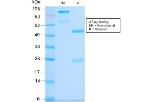 SDS-PAGE Analysis Purified CD63 Rabbit Recombinant Monoclonal Antibody (LAMP3/2990R). (Recombinant CD63 antibody)