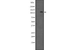 Western blot analysis of PRKD3 expression in HEK293 cells ,The lane on the left is treated with the antigen-specific peptide. (PRKD3 antibody  (N-Term))