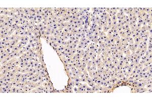 Immunohistochemistry (IHC) image for anti-Caveolin 1, Caveolae Protein, 22kDa (CAV1) (AA 2-105) antibody (ABIN7431326)