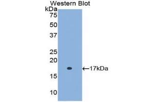 Western blot analysis of the recombinant protein. (Retinol Binding Protein 5 antibody  (AA 1-135))