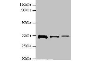 Western blot All lanes: STK16 antibody at 12 μg/mL Lane 1: A549 whole cell lysate Lane 2: Mouse brain tissue Lane 3: A431 whole cell lysate Secondary Goat polyclonal to rabbit IgG at 1/10000 dilution Predicted band size: 35 kDa Observed band size: 35 kDa (STK16 antibody  (AA 1-305))