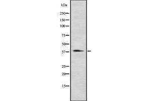 Western blot analysis of P2RY12 using Jurkat whole cell lysates (P2RY12 antibody  (N-Term))