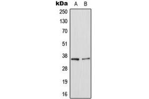 Western blot analysis of Galectin 8 expression in HepG2 (A), NIH3T3 (B) whole cell lysates. (LGALS8 antibody  (Center))