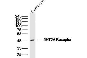 Mouse cerebrum lysates probed with 5HT2A Receptor Polyclonal Antibody, Unconjugated  at 1:300 dilution and 4˚C overnight incubation. (HTR2A antibody  (AA 21-120))