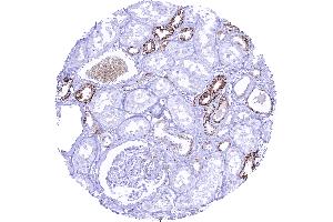 anti-L1 Cell Adhesion Molecule (L1CAM) (AA 550-900) antibody