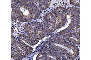 IHC analysis of SARS2 using anti-SARS2 antibody (ABIN7601804). (SARS2 antibody  (AA 46-518))