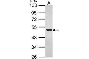 WB Image Sample (30 ug of whole cell lysate) A: H1299 10% SDS PAGE MAGEB1 antibody antibody diluted at 1:1000 (MAGEB1 antibody  (Center))