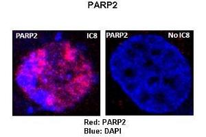 Sample Type :  Rat thyrocytes-FRTL-5   Primary Antibody Dilution :   1:100   Secondary Antibody :  Anti-rabbit-Texas Red   Secondary Antibody Dilution :   1:100   Color/Signal Descriptions :  Red: PARP2 Blue: DAPI   Gene Name :  P Submitted by :  Syed A Morshed, Mount Sinai School of Medicine and James J Peters VA Medical Center (PARP2 antibody  (Middle Region))