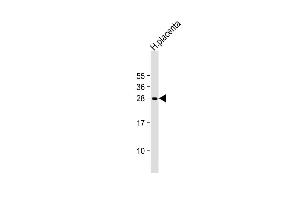Anti-DENR Antibody (Center) at 1:2000 dilution + human placenta lysate Lysates/proteins at 20 μg per lane. (Density Regulated Protein antibody  (AA 47-76))
