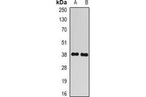 Western blot analysis of BCLG expression in mouse liver (A), rat brain (B) whole cell lysates. (BCL2L14 antibody)