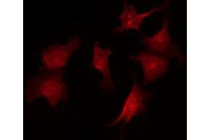 ABIN6267535 staining A2780 by IF/ICC. (CDKN1B antibody  (pSer10))