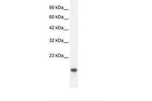 Image no. 2 for anti-C-Myc Binding Protein (MYCBP) (C-Term) antibody (ABIN202015) (MYCBP antibody  (C-Term))