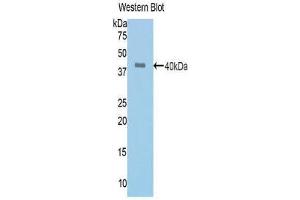 Western Blotting (WB) image for anti-Angiotensin I Converting Enzyme (Peptidyl-Dipeptidase A) 1 (ACE) (AA 504-597) antibody (ABIN1171910)