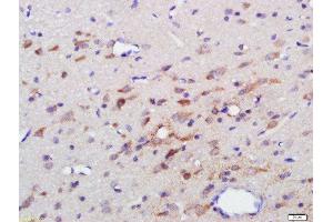 Paraformaldehyde-fixed, paraffin embedded rat brain, Antigen retrieval by boiling in sodium citrate buffer (pH6) for 15min, Block endogenous peroxidase by 3% hydrogen peroxide for 30 minutes, Blocking buffer (normal goat serum) at 37°C for 20min, Antibody incubation with 5HT1F Receptor/SR-1F Polyclonal Antibody, Unconjugated ( 	 at 1:500 overnight at 4°C, followed by a conjugated secondary and DAB staining. (HTR1F antibody  (AA 1-100))