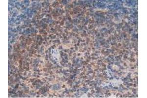 IHC-P analysis of Rat Spleen Tissue, with DAB staining. (ITGAD antibody  (AA 879-1099))