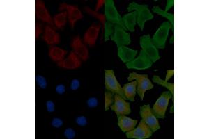 ABIN6256761 and ABIN6267621 staining Hela cells by IF/ICC.