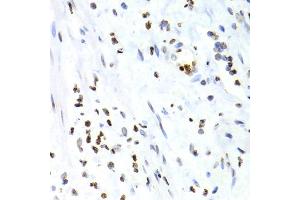 Immunohistochemistry of paraffin-embedded human vermiform appendix using NFKB2 Antibody (ABIN1873900) at dilution of 1:100 (40x lens). (NFKB2 antibody)