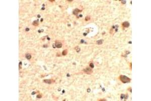 Immunohistochemistry of RUSC2 in human brain tissue with RUSC2 antibody at 5 ug/mL. (RUSC2 antibody  (N-Term))