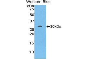 Detection of Recombinant LRRC32, Mouse using Polyclonal Antibody to Leucine Rich Repeat Containing Protein 32 (LRRC32) (LRRC32 antibody  (AA 400-643))