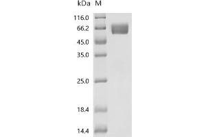 (Tris-Glycine gel) Discontinuous SDS-PAGE (reduced) with 5 % enrichment gel and 15 % separation gel.