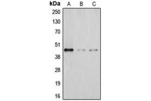 Western blot analysis of DHPS expression in Jurkat (A), JAR (B), HeLa (C) whole cell lysates. (DHPS antibody  (Center))