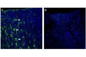 Expression of MAGT1 in rat cortex.