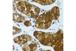 Immunohistochemistry (Paraffin-embedded Sections) (IHC (p)) image for anti-Cholesteryl Ester Transfer Protein (CETP) (AA 300-493) antibody (ABIN3021919)