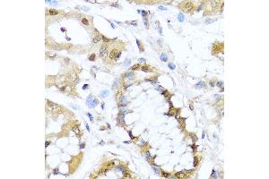 Immunohistochemistry of paraffin-embedded human stomach using TET2 antibody at dilution of 1:100 (40x lens). (TET2 antibody)
