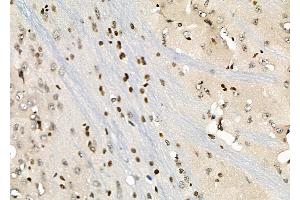 ABIN6258846 and ABIN6274264 at 1/100 staining Rat brain tissue by IHC-P.