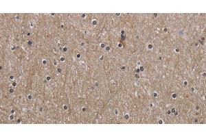 Immunohistochemistry of paraffin-embedded Human brain using PPAT Polyclonal Antibody at dilution of 1:50 (PPAT antibody)