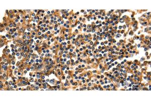 Immunohistochemistry of paraffin-embedded Human tonsil using ANXA5 Polyclonal Antibody at dilution of 1:40 (Annexin V antibody)