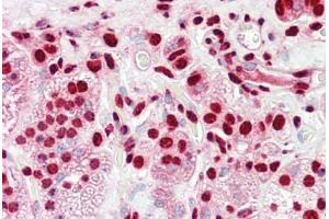 Anti-HnRNP K antibody IHC staining of human adrenal. (HNRNPK antibody  (AA 1-50))