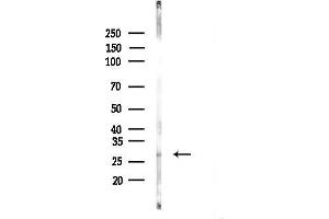 anti-DCN1, Defective in Cullin Neddylation 1, Domain Containing 5 (DCUN1D5) (N-Term) antibody