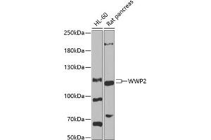 Western blot analysis of extracts of various cell lines, using WWP2 antibody (ABIN6128368, ABIN6150276, ABIN6150277 and ABIN6222535) at 1:1000 dilution. (WWP2 antibody  (AA 1-270))