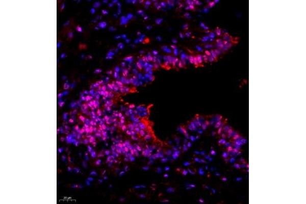 SUV39H1 antibody