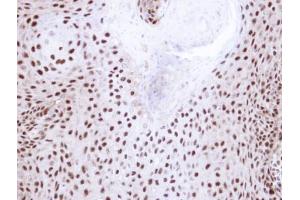 IHC-P Image Immunohistochemical analysis of paraffin-embedded Cal27 xenograft, using NHP2-like protein 1, antibody at 1:100 dilution. (NHP2L1 antibody  (full length))