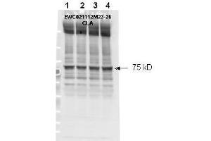 Affinity purified phospho-specific antibody to NF2 (Merlin) at pS518 was used at a 1:1000 dilution to detect NF2 by Western blot. (Merlin antibody  (pSer518))