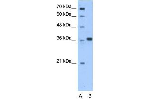 WB Suggested Anti-AASDHPPT Antibody Titration:  0. (AASDHPPT antibody  (C-Term))