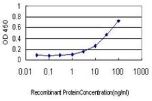 Detection limit for recombinant GST tagged ITGB2 is approximately 0. (Integrin beta 2 antibody  (AA 600-699))