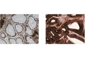 Immunohistochemistry (IHC) image for anti-Chaperonin Containing TCP1, Subunit 2 (Beta) (CCT2) (C-Term) antibody (ABIN264513) (CCT2 antibody  (C-Term))