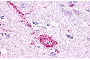 Anti-GPR61 antibody  ABIN1048846 IHC staining of human brain, neurons and glia. (GPR61 antibody  (N-Term))