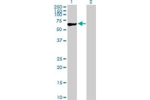 Western Blot analysis of MYBPH expression in transfected 293T cell line by MYBPH MaxPab polyclonal antibody. (MYBPH antibody  (AA 1-477))