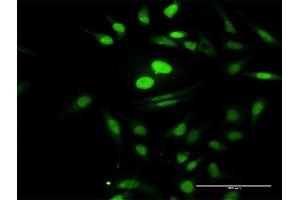 Immunofluorescence of purified MaxPab antibody to PTMS on HeLa cell. (Parathymosin antibody  (AA 1-102))