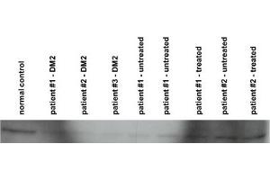 CNBP antibody - N-terminal region  validated by WB using human primary myoblasts at 1:1000.