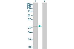 Western Blot analysis of SLC25A5 expression in transfected 293T cell line by SLC25A5 MaxPab polyclonal antibody. (SLC25A5 antibody  (AA 1-298))