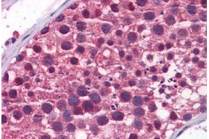 Human Testis: Formalin-Fixed, Paraffin-Embedded (FFPE) (TDRD9 antibody  (AA 1071-1120))