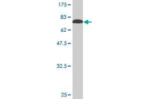 Western Blot detection against Immunogen (76. (STK38L antibody  (AA 1-464))