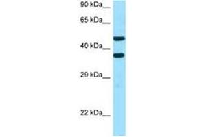 Image no. 1 for anti-Sideroflexin 2 (SFXN2) (AA 186-235) antibody (ABIN6747369) (SFXN2 antibody  (AA 186-235))